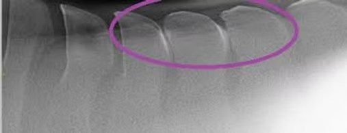 Equine Pilates for Horses can Prevent | Relieve Kissing Spine Symptoms